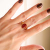 Anillo Muse