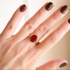 Anillo Muse
